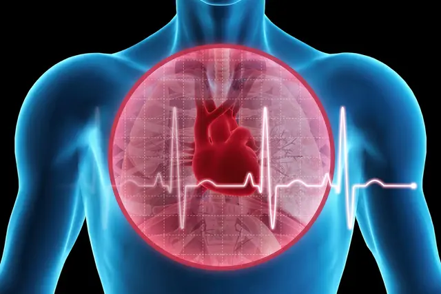 The Main Causes of Heart Failure: High Blood Pressure, Coronary Disease, Diabetes, Viruses, Obesity, and Sleep Apnea