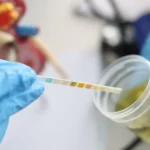 10 posibles causas de sangre en la orina