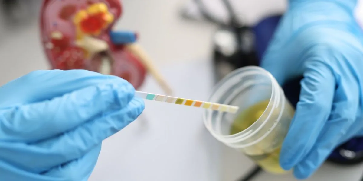 10 Possible Causes of Blood in Urine | español, hematuria, urinary tract infection | español, hematuria, urinary tract infection