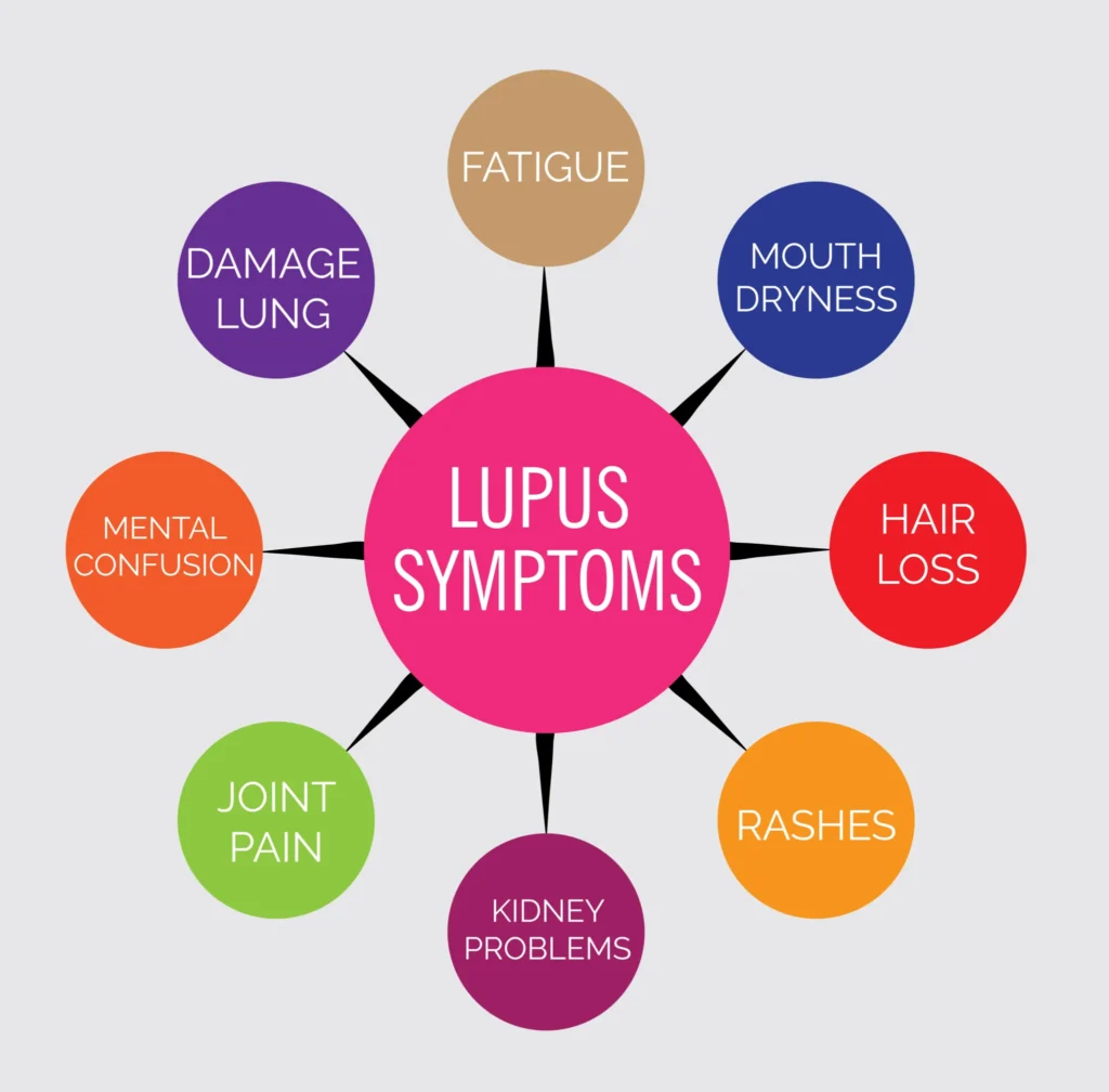 The High Cost of Living with Lupus