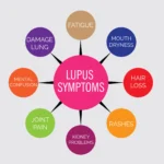 The High Cost of Living with Lupus
