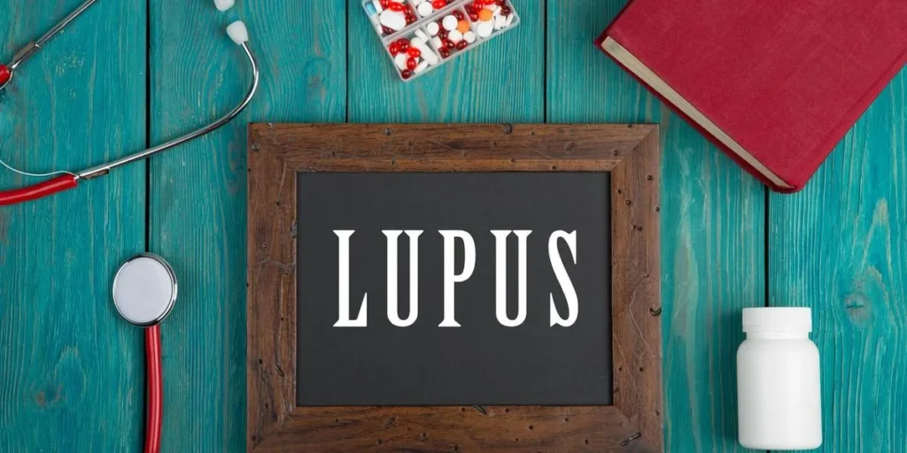 Info About Lupus Analysis – HealthyWomen