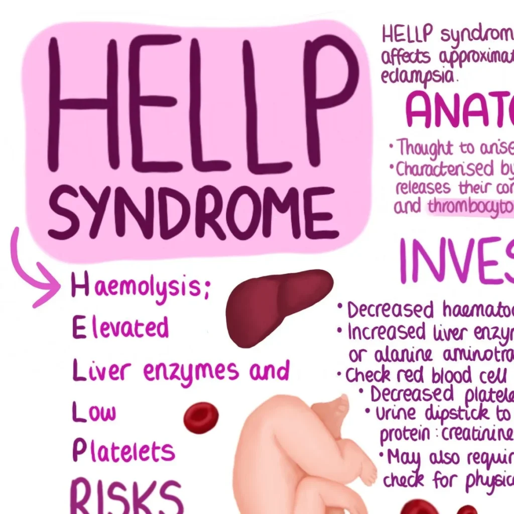 Era upcoming HELLP syndrome – HealthyWomen Era upcoming HELLP syndrome – HealthyWomen