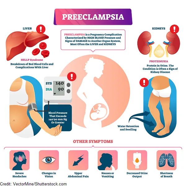 Indicators of Preeclampsia – HealthyWomen