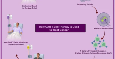 CAR T Mobile Remedy 101