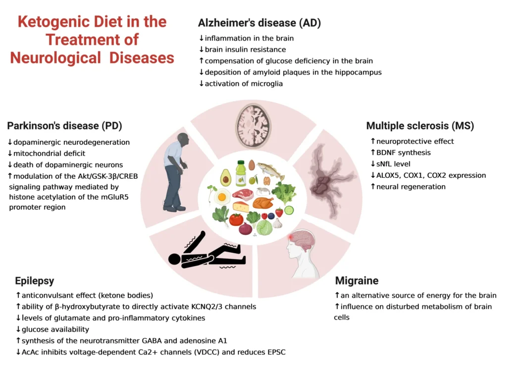 Keto Diet: A Promising Therapy for Managing Neurological Conditions Keto Diet: A Promising Therapy for Managing Neurological Conditions
