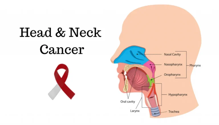 9 Indicators You May Have Head and Neck Most cancers