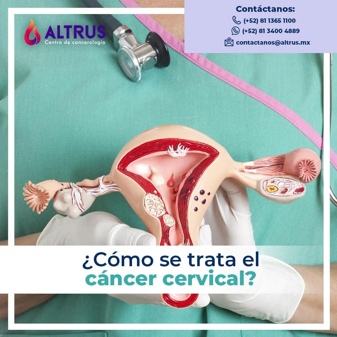 El sexo después del cáncer cervical