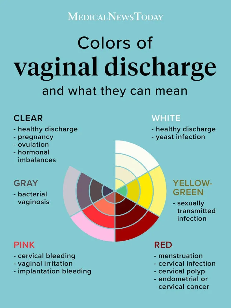 Reasons of Plethora Vaginal Discharge Defined