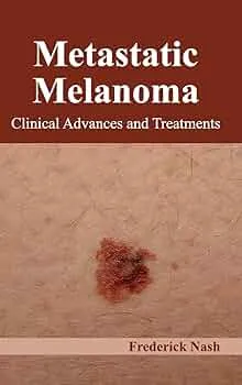 Metastatic Melanoma – HealthyWomen