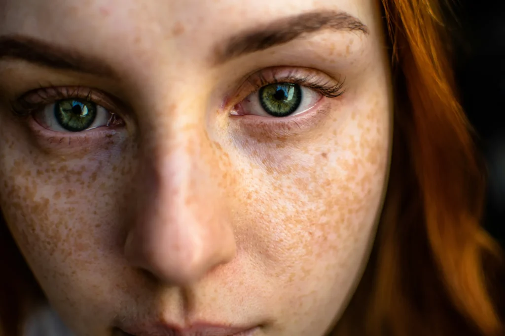 From Acne to Glow: How Keto Can Benefit Your Skin