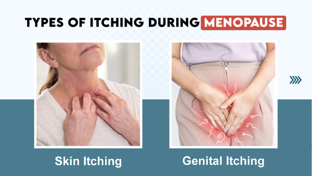 Uncomfortable Truth: Dealing with Itchy Skin in Menopause