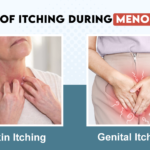 Uncomfortable Truth: Dealing with Itchy Skin in Menopause