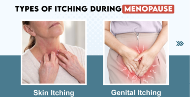 Uncomfortable Truth: Dealing with Itchy Skin in Menopause