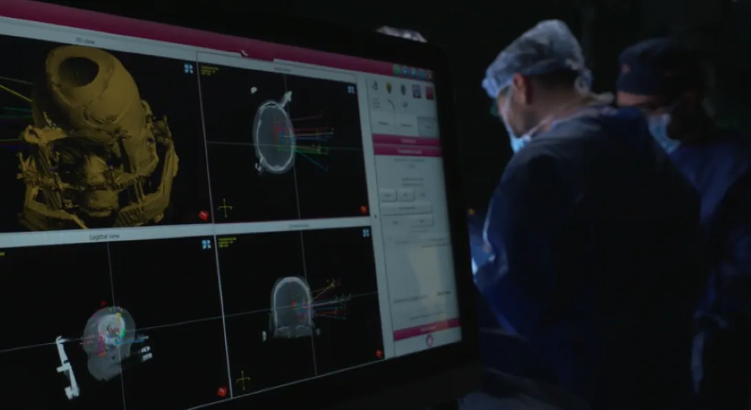 From Seizures to Stability: How the Keto Diet is Transforming Epilepsy Treatment